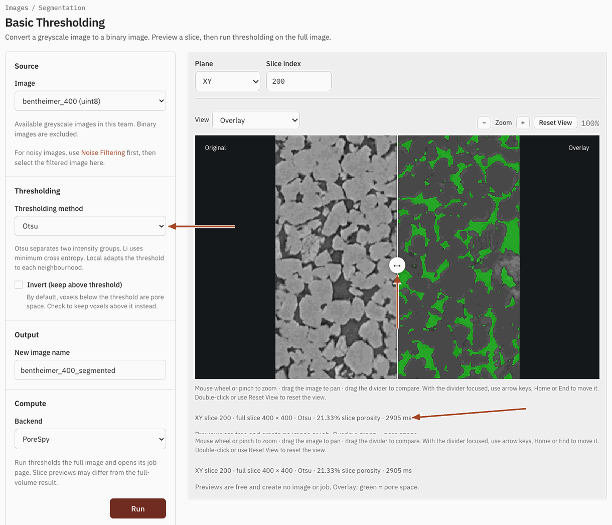 Basic Thresholding previewing an Otsu segmentation of one slice, with a divider comparing it to the scan.